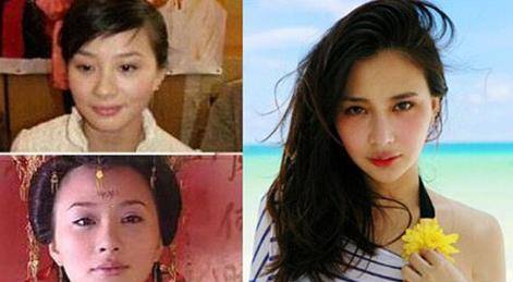 美女整容前后对比_混血女明星鼻子_娱乐圈整容美女